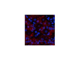TNF alpha Polyclonal Antibody Host Rabbit