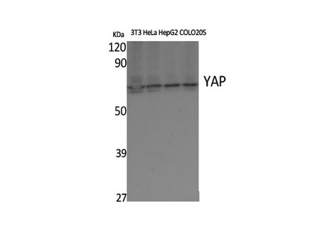 YAP1 Polyclonal Antibody Host Rabbit