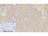 IL8 Polyclonal Antibody Host Rabbit