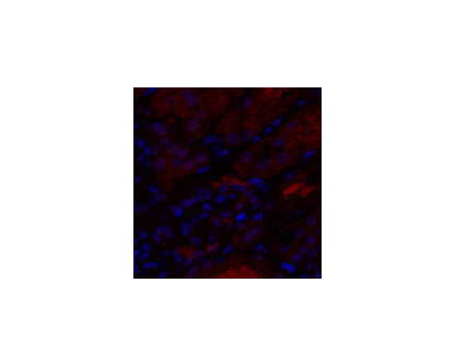 IL8 Polyclonal Antibody Host Rabbit