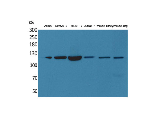 CD133 Polyclonal Antibody Host Rabbit