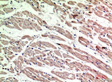 CD206 Polyclonal Antibody