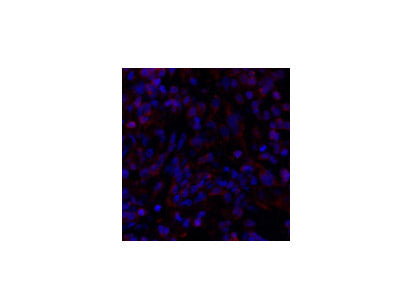 SMAD4 Polyclonal Antibody Storage Store at -20°C