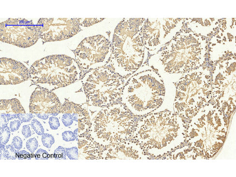 SMAD4 Polyclonal Antibody Storage Store at -20°C