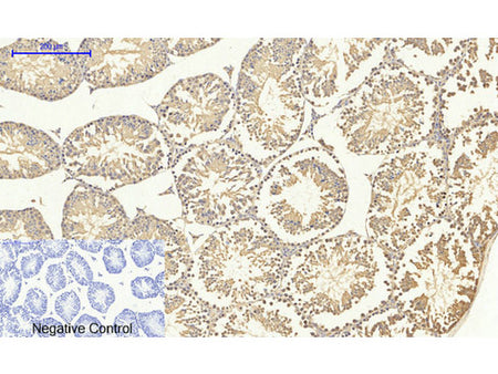 SMAD4 Polyclonal Antibody Storage Store at -20°C
