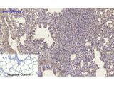 α-SMA Polyclonal Antibody