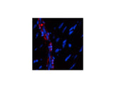 α-SMA Polyclonal Antibody