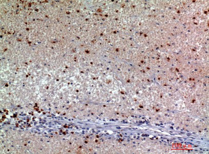 SNCA Polyclonal Antibody Host Rabbit