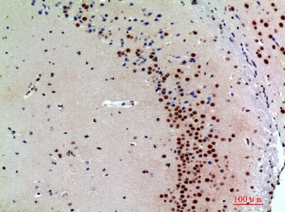 SNCA Polyclonal Antibody Host Rabbit