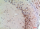 SNCA Polyclonal Antibody Host Rabbit