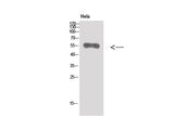 SNCA Polyclonal Antibody Host Rabbit