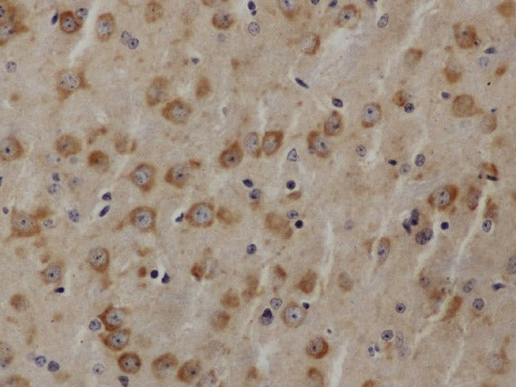 AKT1 Polyclonal Antibody Host Rabbit