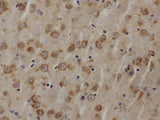 AKT1 Polyclonal Antibody Host Rabbit