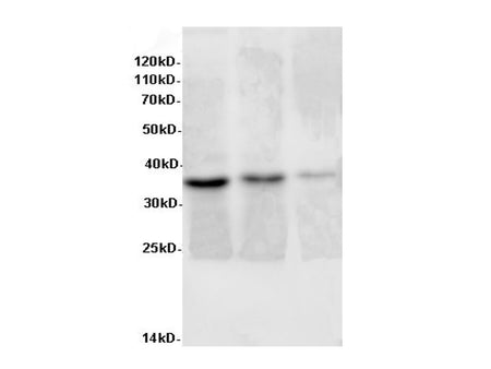 AIMP2 Polyclonal Antibody Host Rabbit