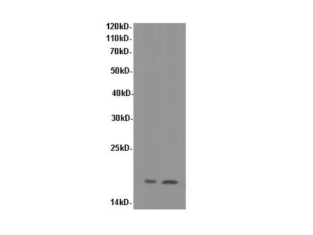 SOD1 Polyclonal Antibody