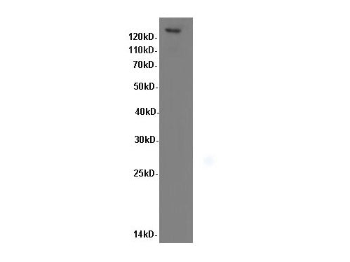 ITGB1 Polyclonal Antibody Reactivity Human