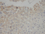 FAS Polyclonal Antibody Reactivity Human