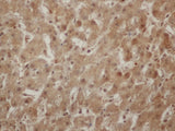 ENO1 Polyclonal Antibody Reactivity Human