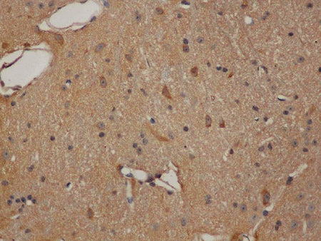 ENO1 Polyclonal Antibody Reactivity Human