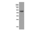 ENO1 Polyclonal Antibody Reactivity Human