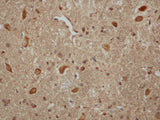 Aβ40 Polyclonal Antibody