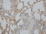Aβ40 Polyclonal Antibody