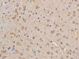 VDAC1 Polyclonal Antibody Reactivity Mouse, Rat