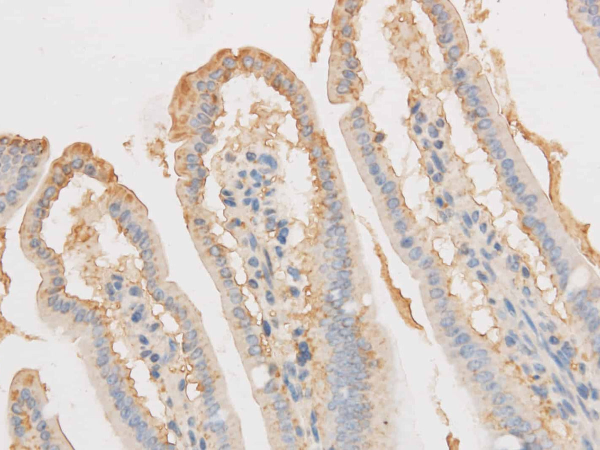 VDAC1 Polyclonal Antibody Reactivity Mouse, Rat