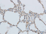 MMP1 Polyclonal Antibody Reactivity Mouse