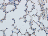 MMP1 Polyclonal Antibody Reactivity Mouse