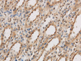 IL10RB Polyclonal Antibody Reactivity Rat