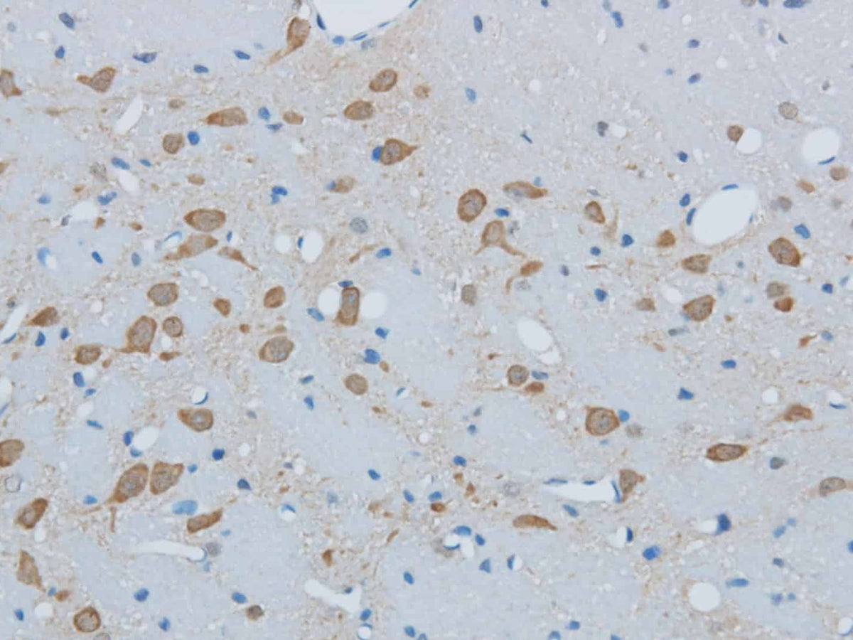 TIMP4 Polyclonal Antibody
