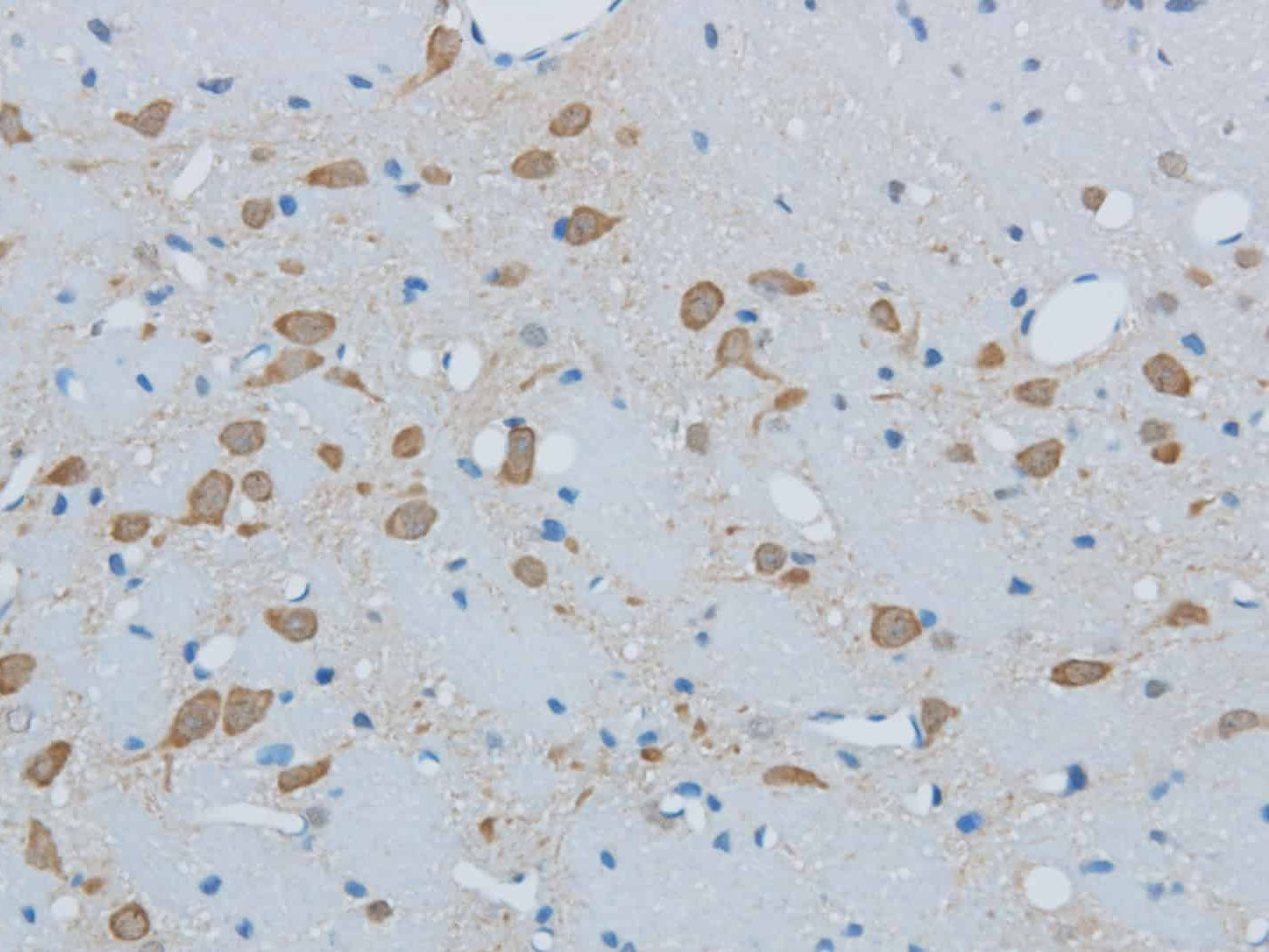 TIMP4 Polyclonal Antibody