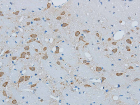 TIMP4 Polyclonal Antibody