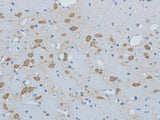 TIMP4 Polyclonal Antibody