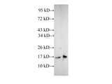 CFL1 Polyclonal Antibody Reactivity Human