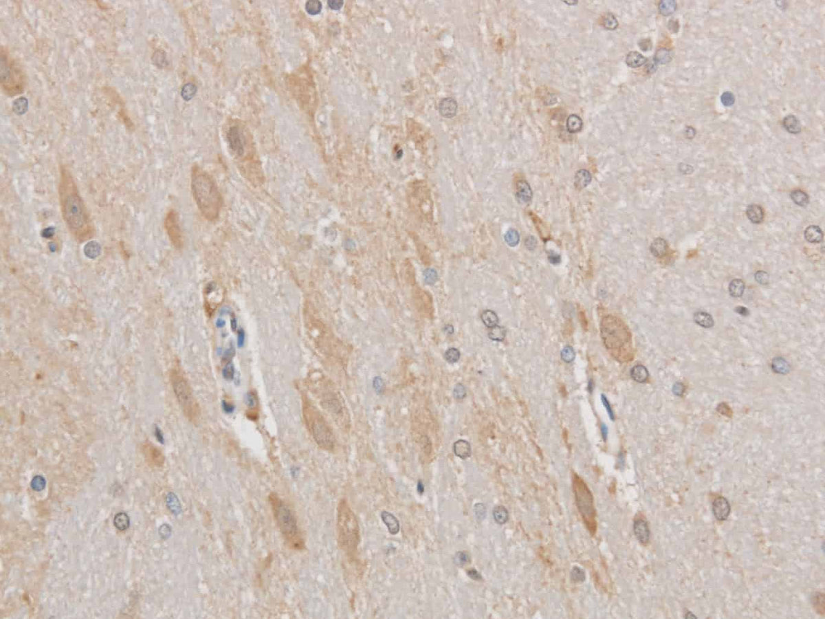 MAP2 Polyclonal Antibody Host Rabbit - Biomarkers - Elabscience Biotechnology - MSE Supplies