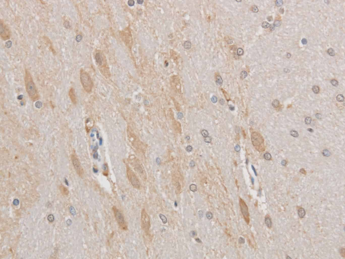 MAP2 Polyclonal Antibody Host Rabbit - Biomarkers - Elabscience Biotechnology - MSE Supplies