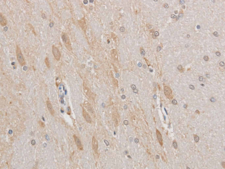 MAP2 Polyclonal Antibody Host Rabbit - Biomarkers - Elabscience Biotechnology - MSE Supplies
