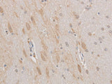 MAP2 Polyclonal Antibody Host Rabbit