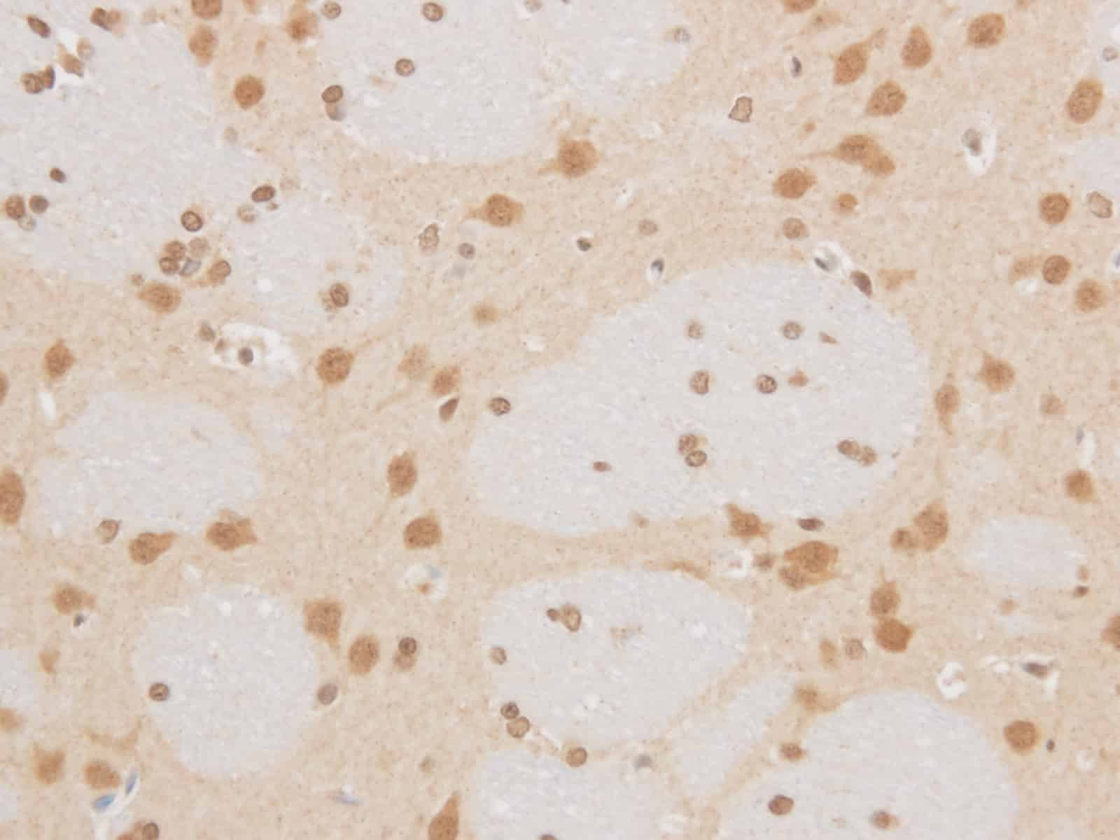 MAP2K6 Polyclonal Antibody Reactivity Mouse