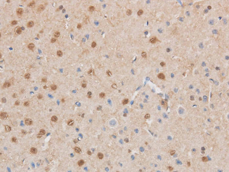 MAP2K6 Polyclonal Antibody Reactivity Mouse