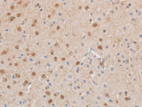 MAP2K6 Polyclonal Antibody Reactivity Mouse