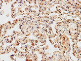 IMP3 Polyclonal Antibody Reactivity Human