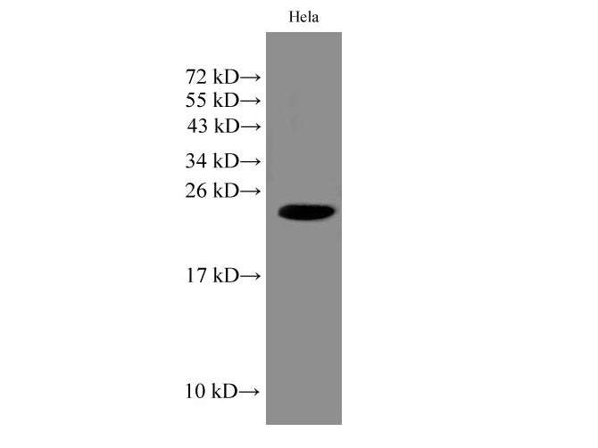 IMP3 Polyclonal Antibody Reactivity Human