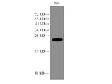 IMP3 Polyclonal Antibody Reactivity Human