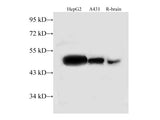 TUFM Polyclonal Antibody Reactivity Human