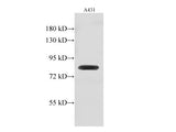 GUSB Polyclonal Antibody Reactivity Human