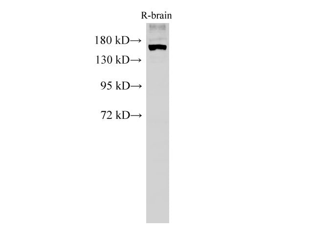 PARD3 Polyclonal Antibody