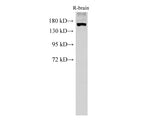 PARD3 Polyclonal Antibody
